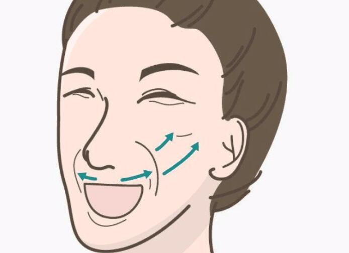 激光可以去除法令纹吗(法令纹产生比较快的原因)