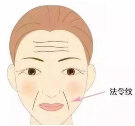 激光去法令纹有哪些操作步骤呢(如何防治法令纹) 激光去法令纹有哪些操作步骤呢(如何防治法令纹)