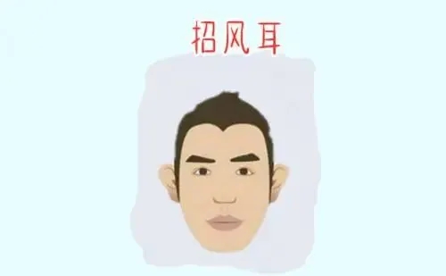南宁招风耳矫正的方法有哪些(招风耳矫正效果好吗好不好看下面就知道)
